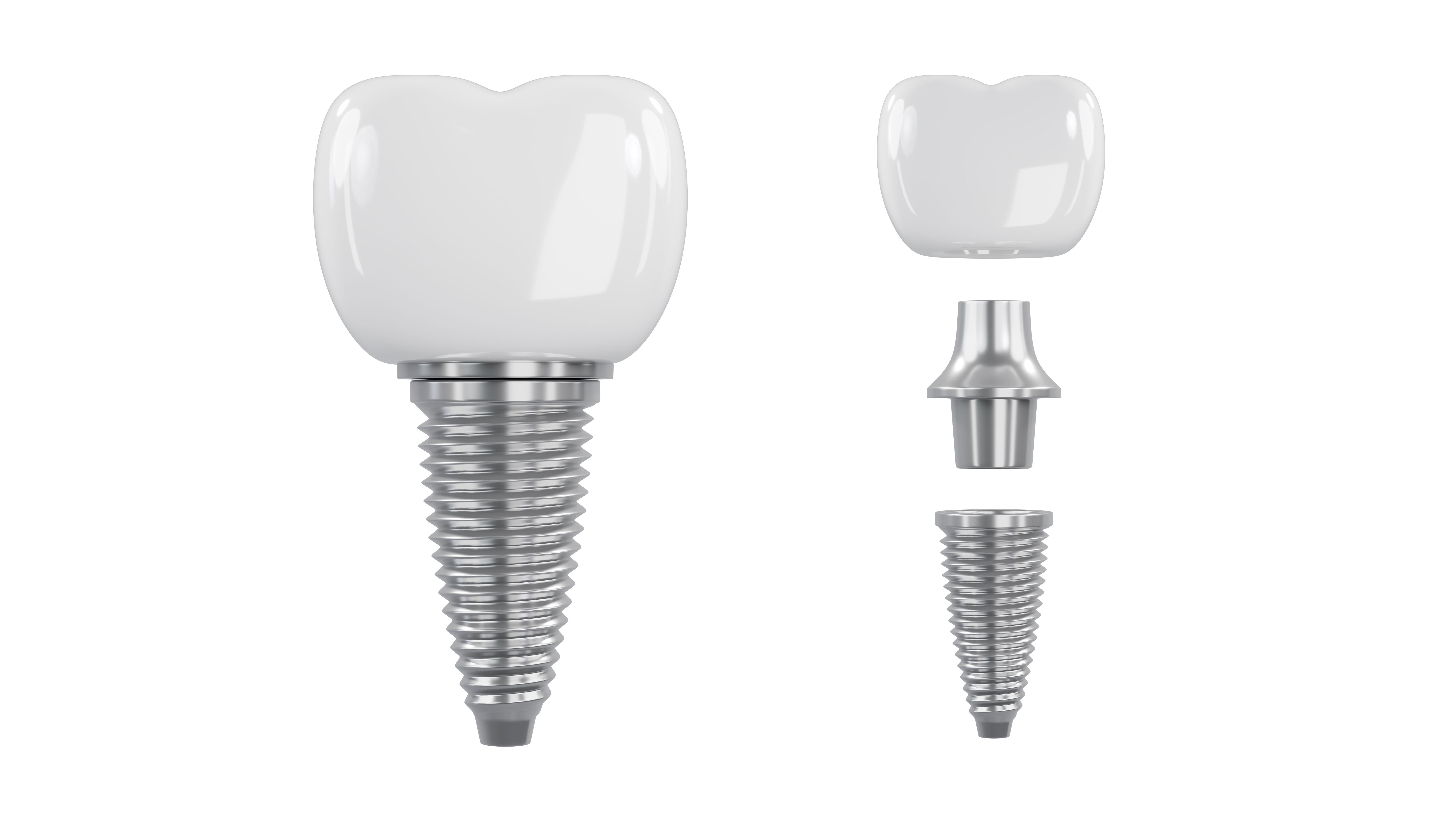 Implantat illustration